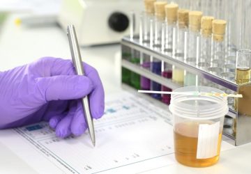 analisi delle urine