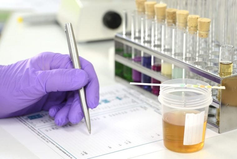 analisi delle urine