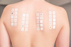 patch test