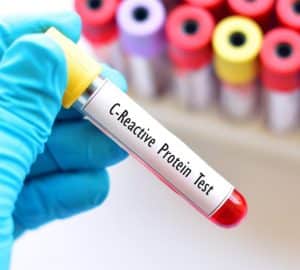 proteina c reattiva