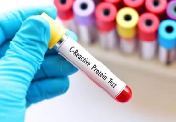 proteina c reattiva