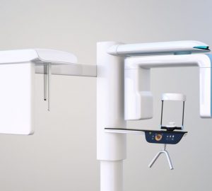 tac cone beam dentale