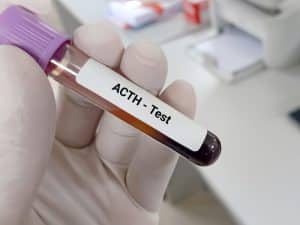 test acth