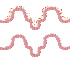 Microbiota