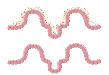 Microbiota
