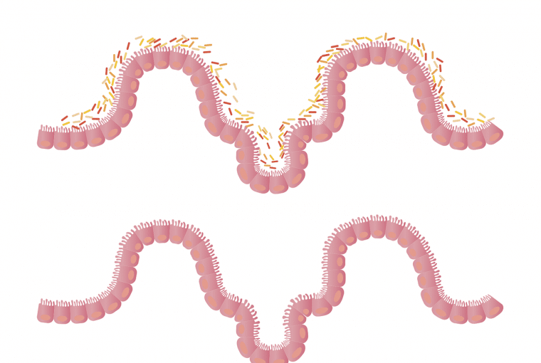 Microbiota