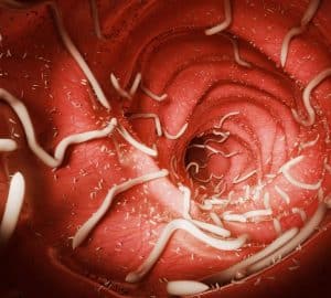 parassiti intestinali