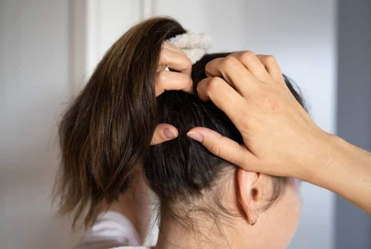 donna che si gratta i capelli