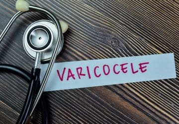 Varicocele