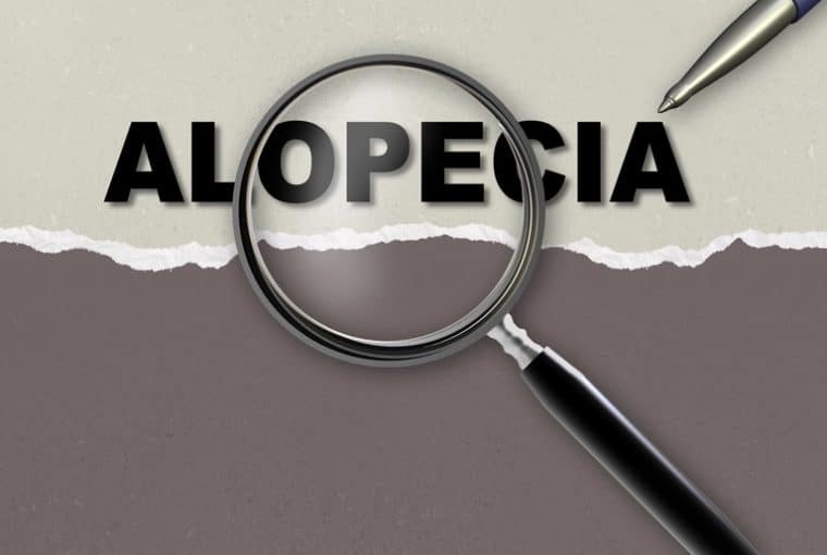 Alopecia