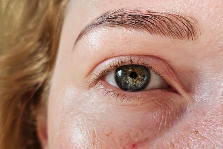 capillari rotti sul viso di donna