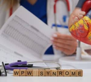 Quando la sindrome di WPW accelera il cuore: segnali, ECG e terapie