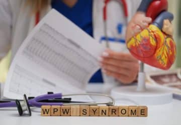 Quando la sindrome di WPW accelera il cuore: segnali, ECG e terapie