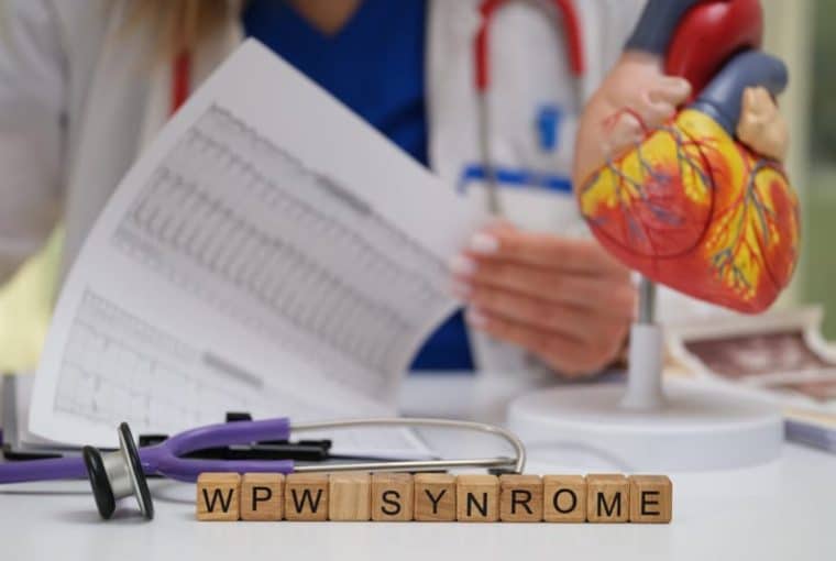 Quando la sindrome di WPW accelera il cuore: segnali, ECG e terapie