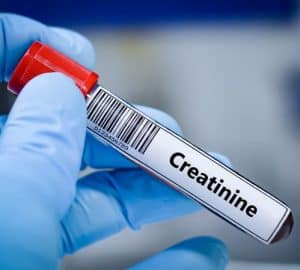Esame creatinina