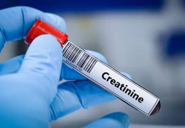 Esame creatinina