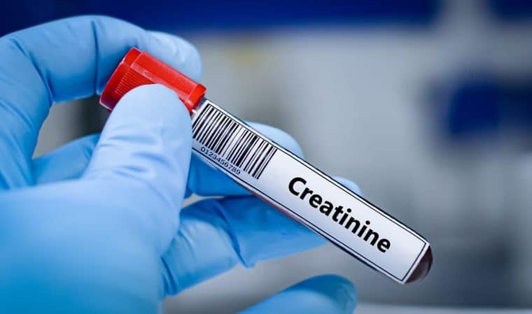 Esame creatinina